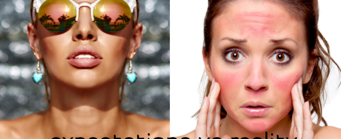 Expectation vs. Reality – TAN or BURN – choice is yours…