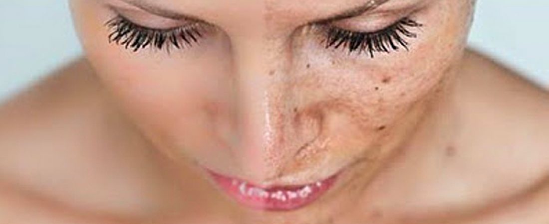 SUNSCREEN  vrs  AGEING